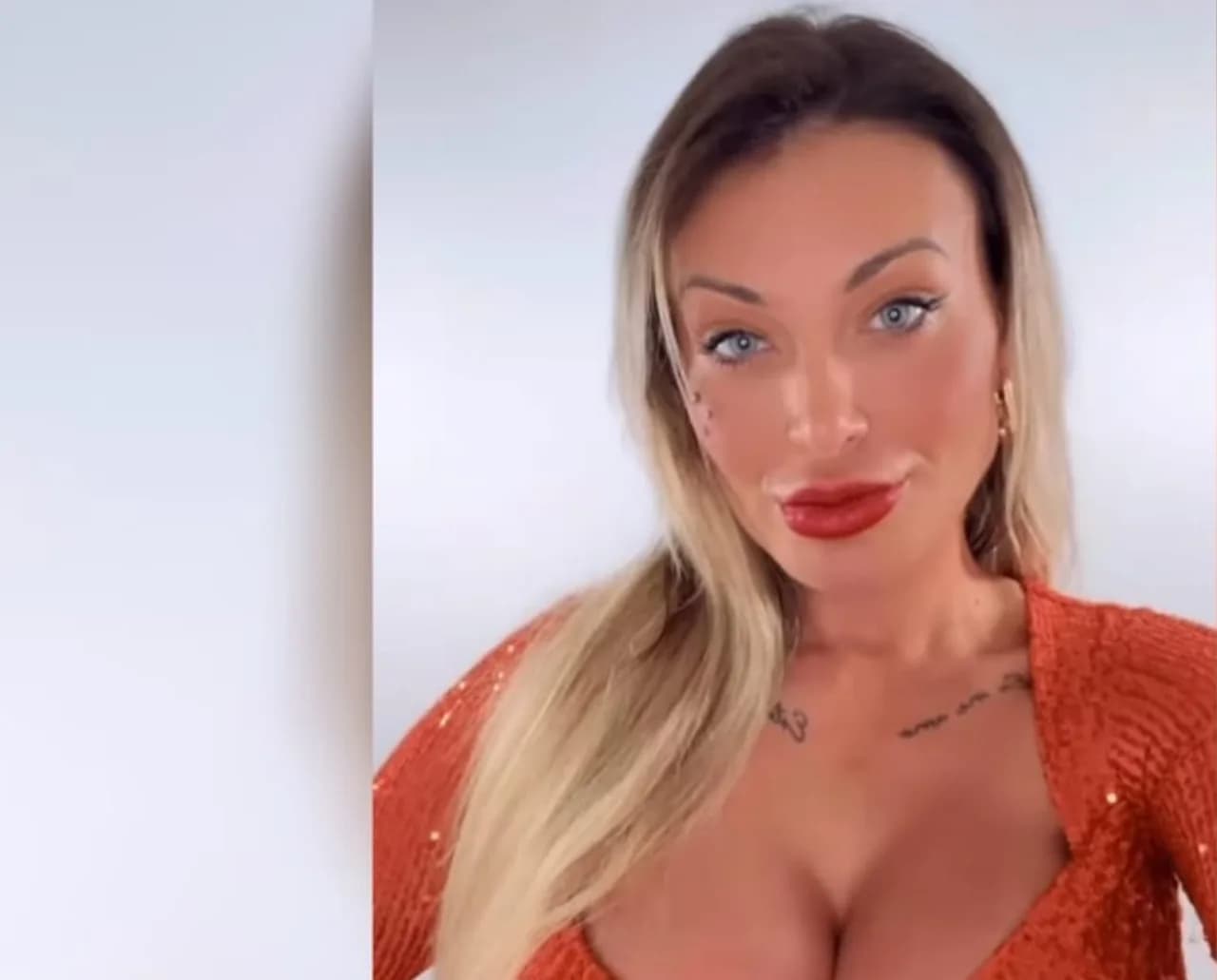 Andressa Urach mostra antes e depois com Deep Plane e Fox Eyes